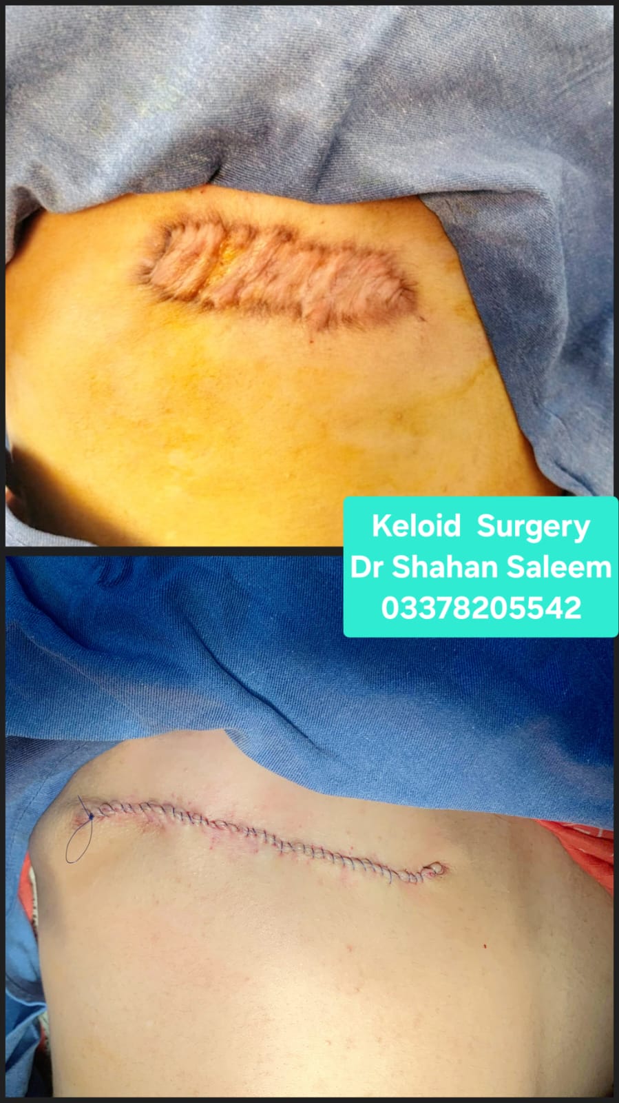 Before & After 17